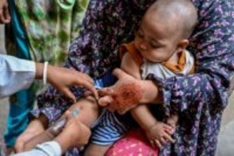 バングラデシュではしか大流行、子ども２２７人死亡 感染疑い例３万５０００件