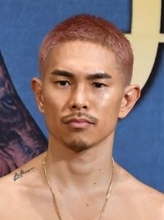井岡が眼窩底骨折