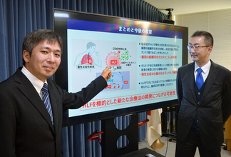 慢性炎症を制御するたんぱく質＝原因の免疫細胞、組織にとどめる―千葉大発見、ぜんそくなど新治療法期待