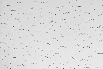 「虫みたい」とSNSで話題の病院の天井、なぜこの柄？建材会社が明かした“メリット”