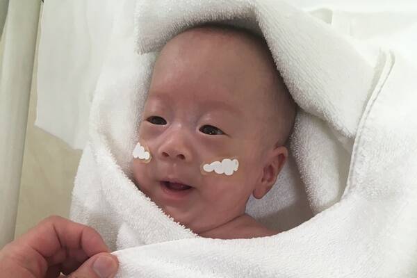 世界最小赤ちゃんの奇跡 289gだった女児は間もなく20歳に 2019年3月11