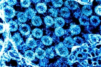 2m超えてもウイルスが…無換気の密閉空間で空気感染の可能性