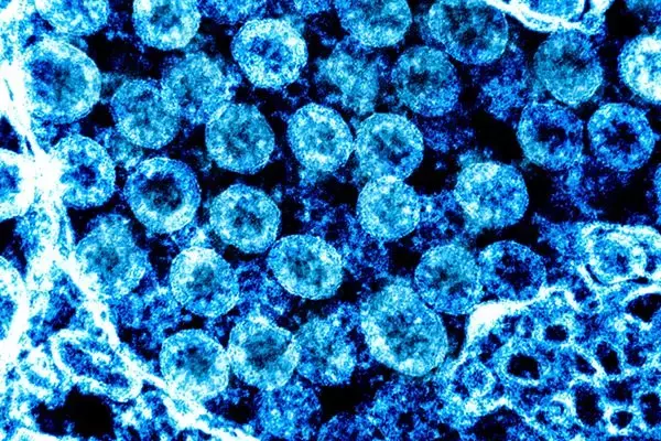 2m超えてもウイルスが…無換気の密閉空間で空気感染の可能性