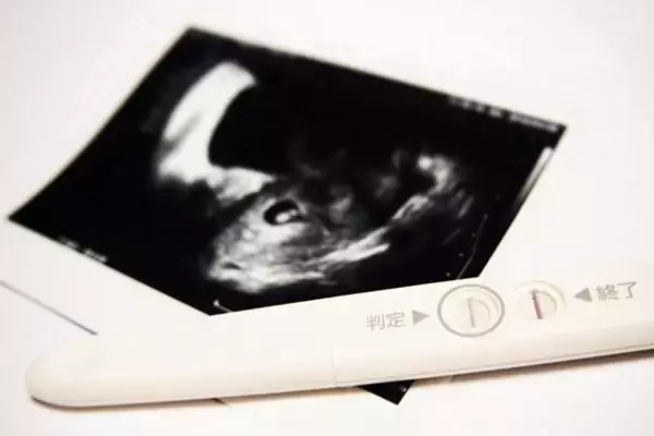 不妊治療保険適用で“手抜き診療”増える？専門家が解説