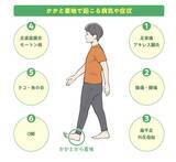 「痩せるだけじゃない！ 知っておきたいウォーキング“7つの効果”と知られざるデメリット」の画像2