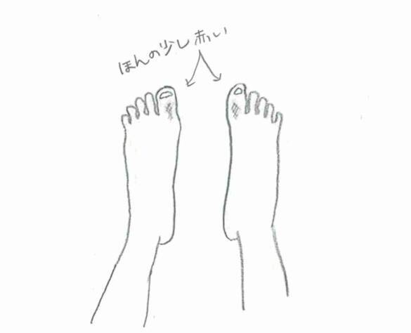 「おばあちゃんがかかる病気でしょ？」33歳・働き盛り女性が直面した“重大な病”の正体。「覚えのない痛み」が1年後、歩行困難に至るまで