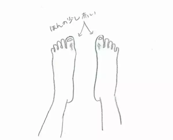 「「おばあちゃんがかかる病気でしょ？」33歳・働き盛り女性が直面した“重大な病”の正体。「覚えのない痛み」が1年後、歩行困難に至るまで」の画像