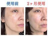 「使ってよかった！噂の美容液を2ケ月ぬった49歳、顔の老けサインに見られた変化」の画像1