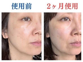 使ってよかった！噂の美容液を2ケ月ぬった49歳、顔の老けサインに見られた変化