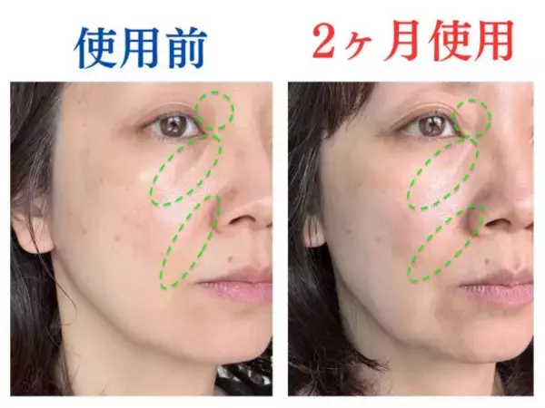 「使ってよかった！噂の美容液を2ケ月ぬった49歳、顔の老けサインに見られた変化」の画像