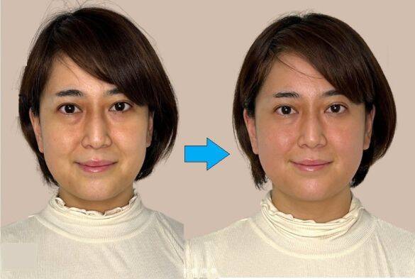 顔のくすみ・クマから不眠まで。コスメや薬に頼らない、“体の根本”に届く解決法とは？