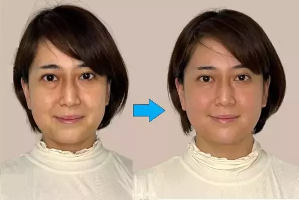 「顔のくすみ・クマから不眠まで。コスメや薬に頼らない、“体の根本”に届く解決法とは？」の画像