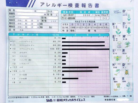 「全身ぶつぶつ、顔はパンパン」で修学旅行から帰ってきた娘。誰にでもありえる、突然ダニアレルギーを発症するリスク【医師監修】
