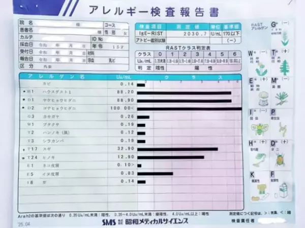 「「全身ぶつぶつ、顔はパンパン」で修学旅行から帰ってきた娘。誰にでもありえる、突然ダニアレルギーを発症するリスク【医師監修】」の画像