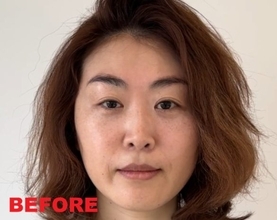 年齢とともに目が小さくなって…。まぶたが垂れてくる問題をどうする？根本解決から簡単テクまで