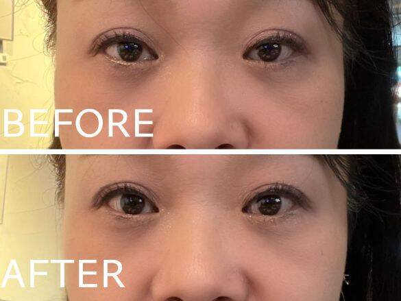 年齢とともに目が小さくなって…。まぶたが垂れてくる問題をどうする？根本解決から簡単テクまで