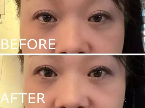 「年齢とともに目が小さくなって…。まぶたが垂れてくる問題をどうする？根本解決から簡単テクまで」の画像