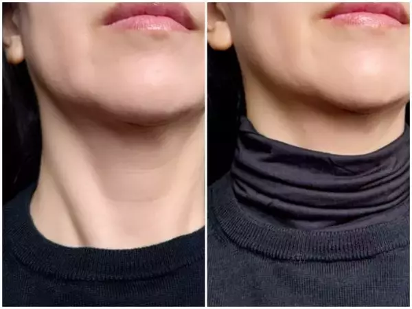 「首が老ける人」が無意識にやっていること。“スマホの見すぎ”だけじゃない、今すぐやめたい3大NG習慣