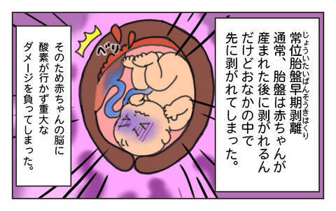 破水かと思ったら大量の血が…「出産時のトラブル」で我が子が“医療的ケア児”に。母親が体験漫画に込めた思いとは