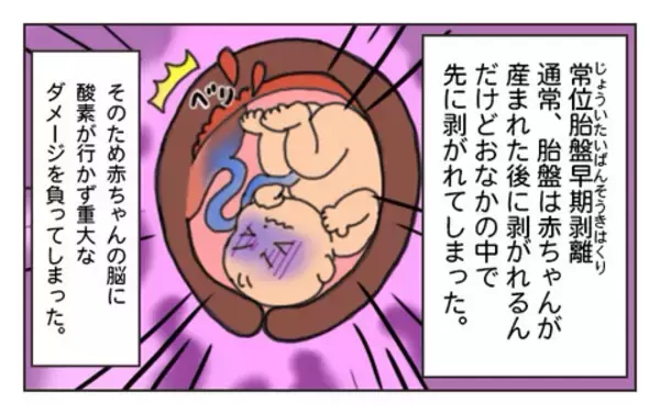 「破水かと思ったら大量の血が…「出産時のトラブル」で我が子が“医療的ケア児”に。母親が体験漫画に込めた思いとは」の画像