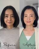 「「うわ可愛くなった！」と話題の55歳。激変した前伊東市長、2つの若返りポイントとは」の画像5