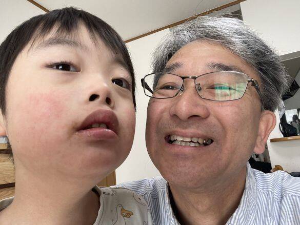 2人の障害児を育てる57歳・元牧師が「出生前診断」の広がりに疑問「弱い者を取り除く社会が本当に豊かなのか」