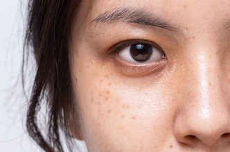 シミや肝斑を隠したいのに逆に目立つ…やりがちなNGメイクと正解テク