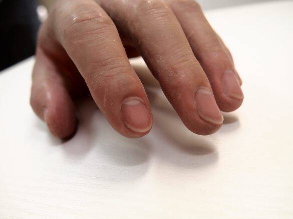 まるで本物…！ 爪の縦線や指紋、シワまで再現して「失われた身体の一部」を作り続ける44歳職人の想い