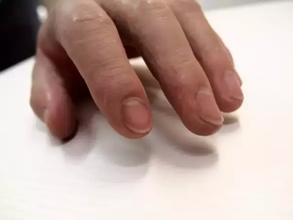 「まるで本物…！ 爪の縦線や指紋、シワまで再現して「失われた身体の一部」を作り続ける44歳職人の想い」の画像
