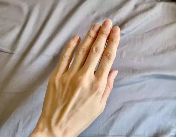 実は30〜50代女性に多い「リウマチ」。33歳で発症した筆者が直面した、想像を絶する“副作用と闘病”のリアル