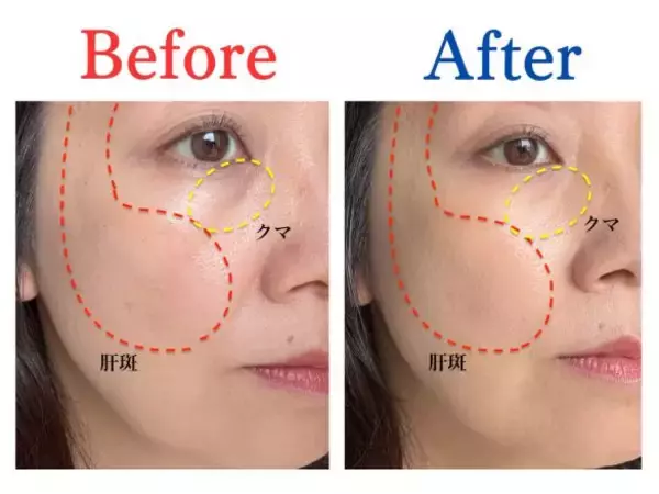 「SNSで話題「ファンデなし、コンシーラーだけでメイク」は40代もアリ？ 48歳が試した結果が「想像を超えていた」」の画像