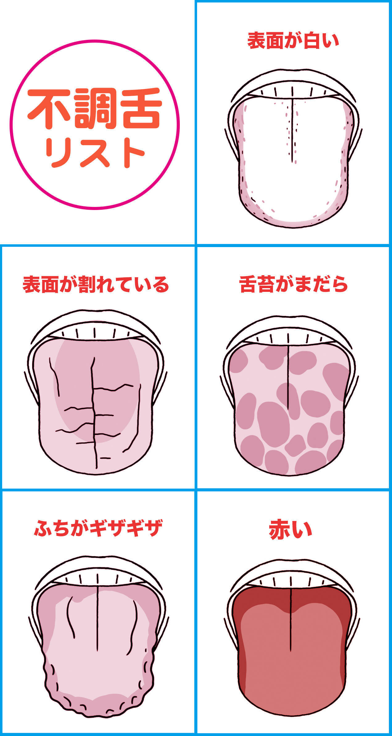 全身の不調は舌に出る 即病院へ行くべき 危険舌 はコレだ 17年4月16日 エキサイトニュース 3 4