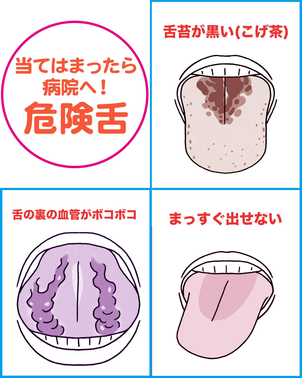 全身の不調は舌に出る 即病院へ行くべき 危険舌 はコレだ 17年4月16日 エキサイトニュース 3 4