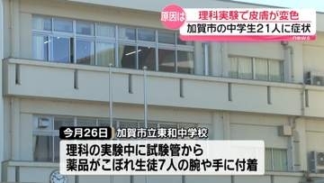 中学校理科の実験で生徒の皮膚が変色　試験管からこぼれた薬品で…石川・加賀市