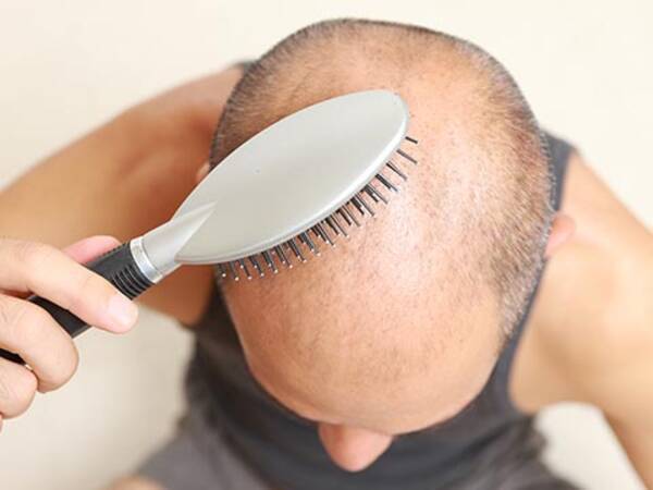 噂を検証 白髪の人ははげないの 16年1月31日 エキサイトニュース