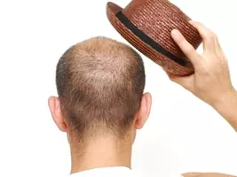 似合う髪型がわかる無料アプリ Ai Stylist 年3月21日 エキサイトニュース