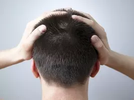 頭皮が白いのは健康の証 頭皮の健康度チェック 14年10月24日 エキサイトニュース