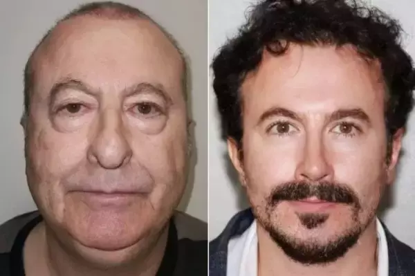 20歳は若く見える！トルコの整形外科医が公開したビフォア・アフターだが実は偽造だったことが判明