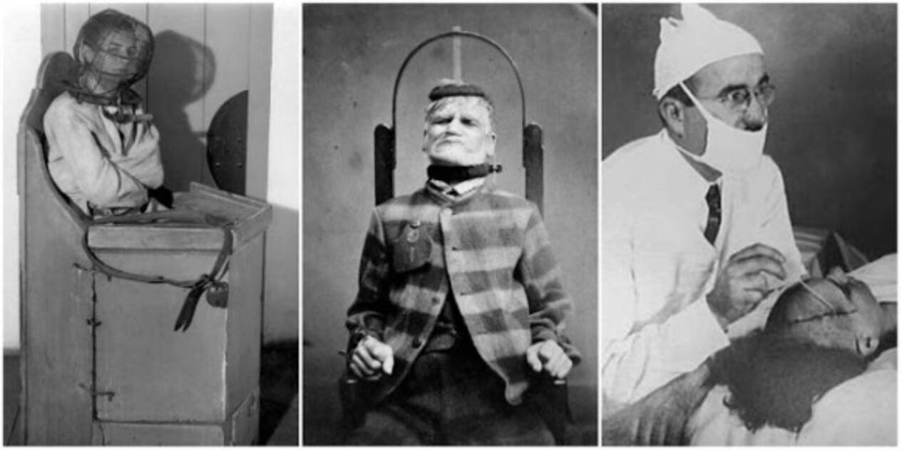 本当にあった昔の精神病院の治療器具と治療風景 1800年代後半 1900年代半ば 19年8月2日 エキサイトニュース