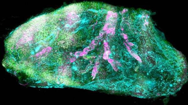 人間の内臓を完全に透明にすることに成功 ドイツ研究 年3月11日 エキサイトニュース