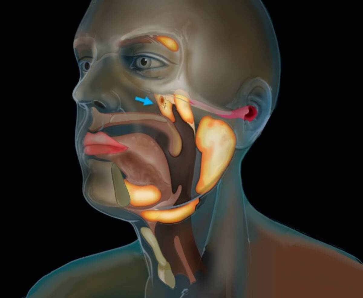 人間の喉の奥に 未知の臓器 を偶然発見 それは第4の唾液腺だった オランダ研究 年10月23日 エキサイトニュース