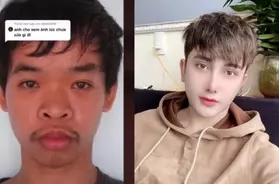 衝撃 26歳ベトナム人男性がルックスのせいで就職できないと整形手術したらこうなった 21年3月3日 エキサイトニュース