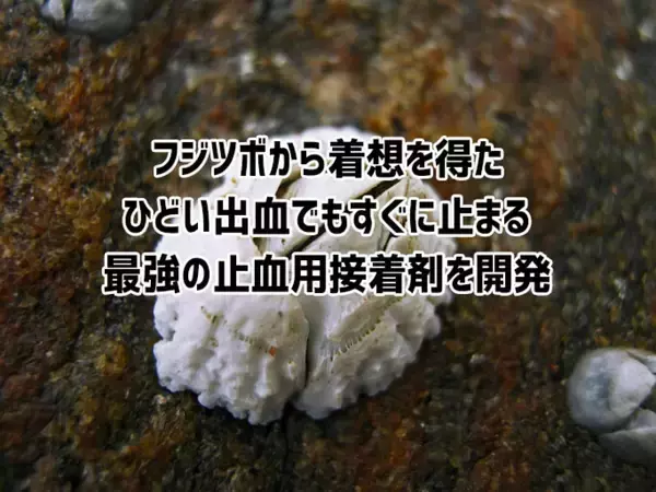 フジツボから着想。ひどい出血もすぐに止まる最強の医療用接着剤が開発される