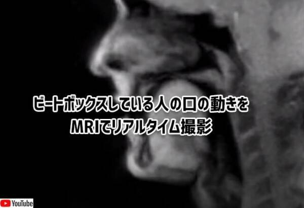 ビートボックスしている人の口の中の動きをmriでリアルタイム撮影 21年9月12日 エキサイトニュース ビートボックスしている人の口の中の動きをmriでリアルタイム撮影 21年9月12日 エキサイトニュース