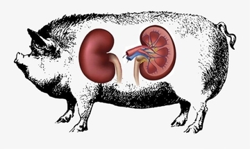 ブタの腎臓を人体に試験的に移植することに成功。異種間臓器移植実現に向けて一歩前進