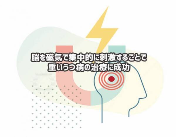 磁気で脳を集中的に刺激することで 重いうつ病を治療することに成功 2021年11月3日 エキサイトニュース