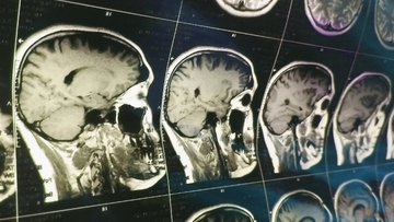 外科手術なしに脳活動から思考を文章化するAIの精度が向上（Meta社）