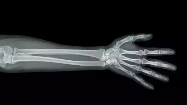 AI生成の偽のレントゲン写真、医師ですら見抜くのが難しいことが明らかに
