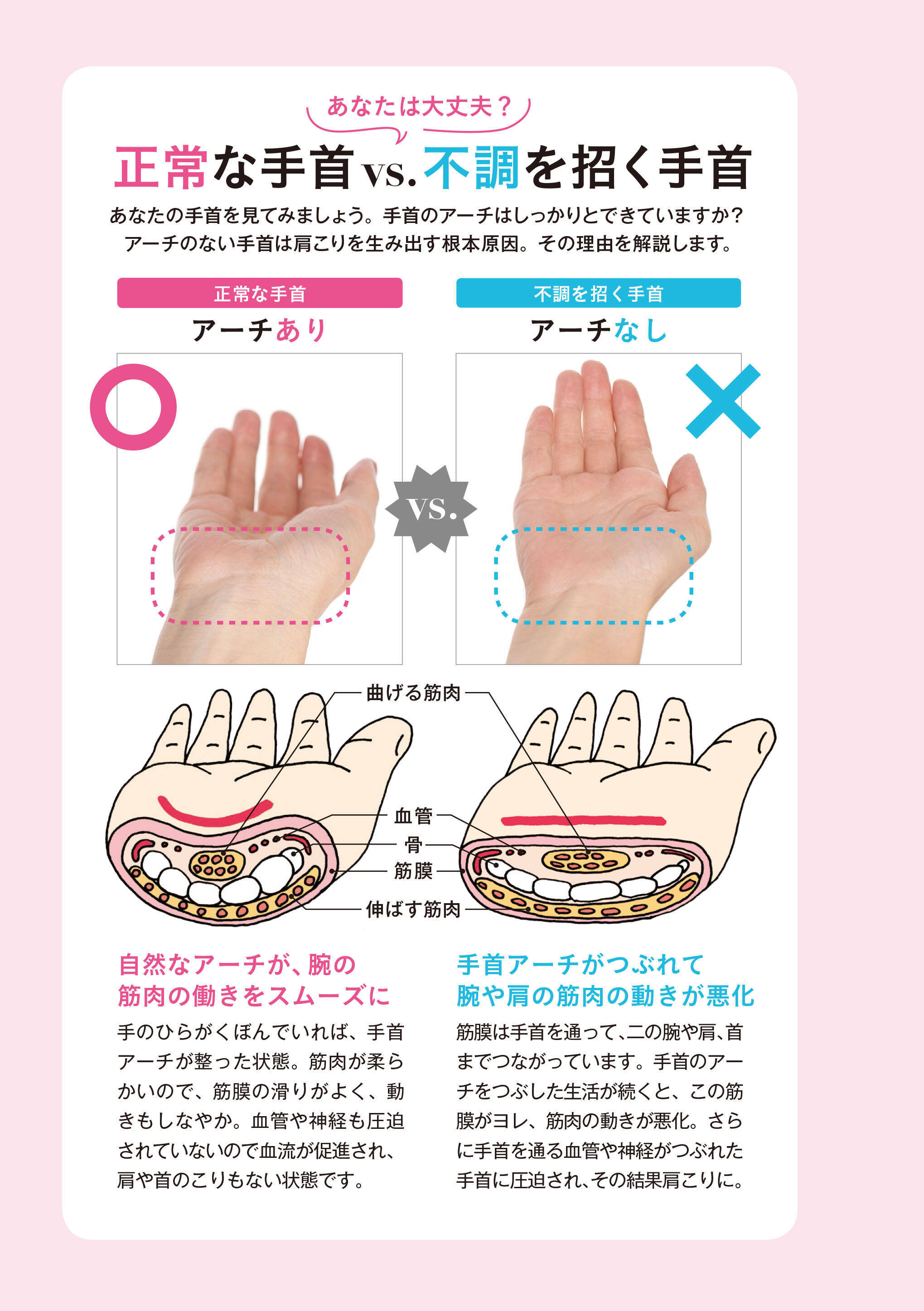 こりの原因は手首にあった 付録 特製サポーターで肩こりをもまずに治す 19年3月9日 エキサイトニュース