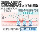 「小腸細胞、大腸の粘膜を修復　慢性炎症で、治療法の改善に期待」の画像1